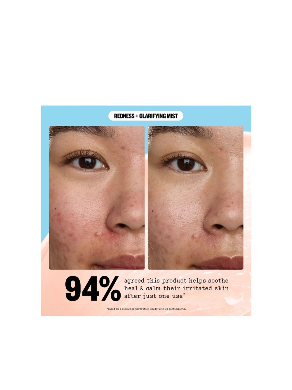Peace Out Redness Reducing + Clarifying Facial Mist - Picture 9 of 10